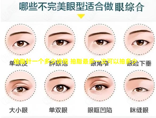 抽脂针一个多少块钱 抽脂最多一次可以抽多少